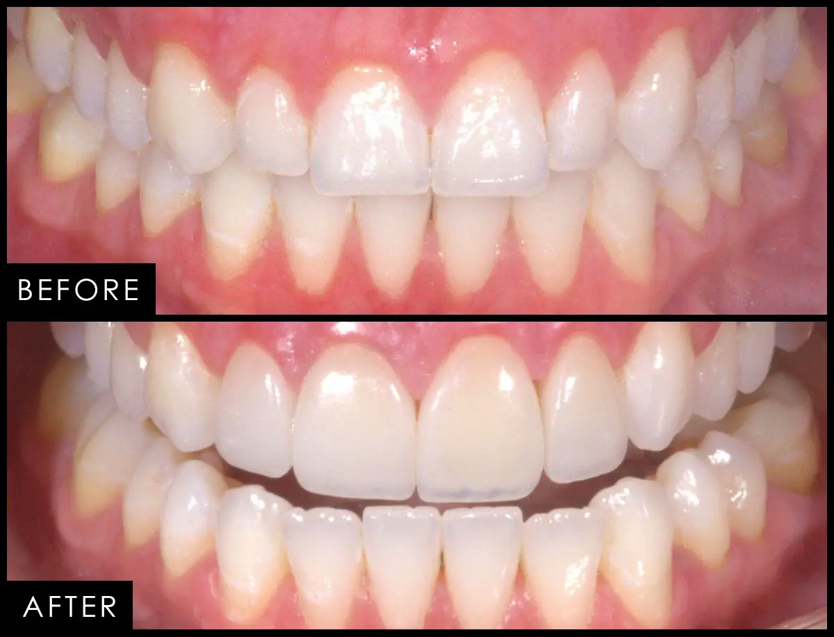 Patient case 09, before and after